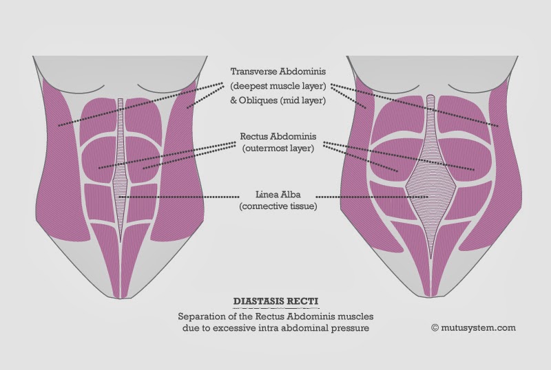 12 Week Diastasis Recti Home Workout Plan - Diary of a Fit Mommy