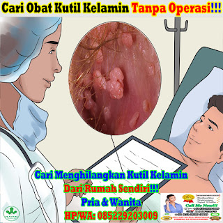 Obat Kutil Kelamin