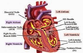 faktor penyebab penyakit jantung