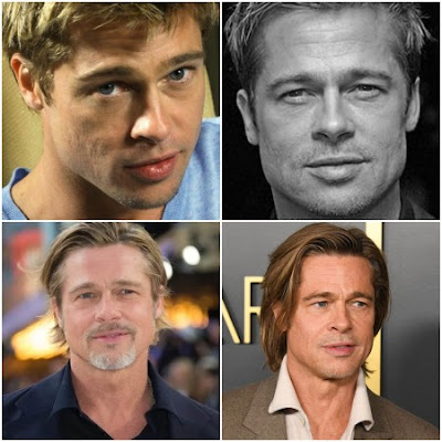 Brad Pitt Acne Scars