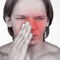9 Gejala dan Ciri-ciri Sinusitis
