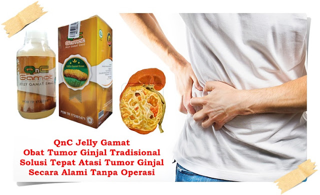 Obat Tumor Ginjal Tradisional