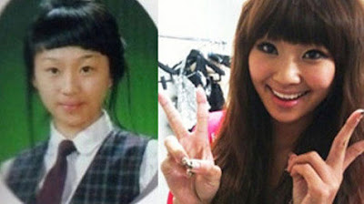 Hyorin Sistar Before After