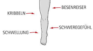   kribbeln in den beinen, kribbeln in den beinen was hilft, kribbeln im bein thrombose, kribbeln in beinen ms, kribbeln am ganzen körper psychisch, kribbeln im linken arm, kribbeln im gesicht, kribbeln in der linken hand herzinfarkt, kribbeln im linken arm und hand