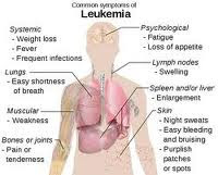 Leukimia