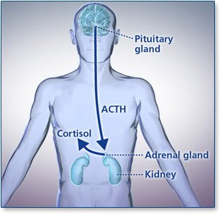 Cushing's Disease Symptoms in Women