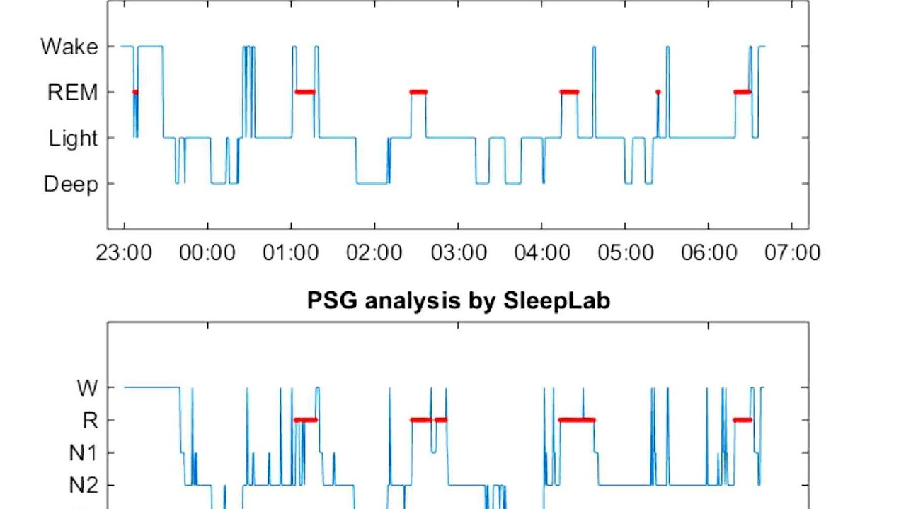 Sleep - Sleep Levels