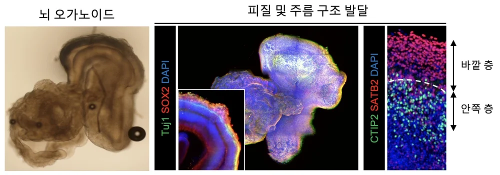 ▲ 뇌 오가노이드의 피질 및 구조 발달을 확인하는 3차원 이미지 분석