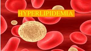 Hyperlipidemia treatment doctors Old Bridge NJ