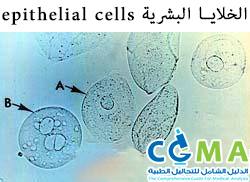 تحليل البول كاملا بالصور Urine Analysis علومنجى دوت كوم