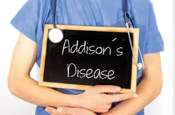 Understanding Addison's Disease: Causes, Symptoms, and Treatment