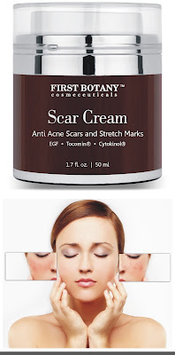 best acne scar cream