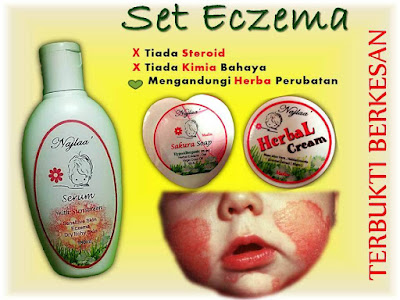 Eczema: Apa itu "Steroid withdrawal Syndrome" ?  NajLaa BaBy