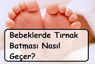 Bebeklerde Tırnak Batması Nasıl Geçer