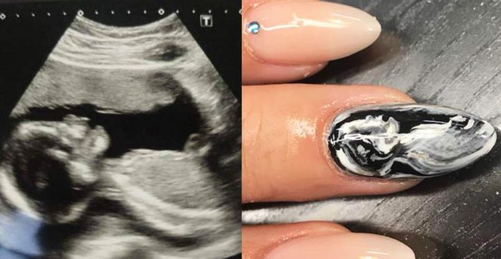 The New Fashion For Pregnant Women Is To Have Her Nail Ultrasound Painted