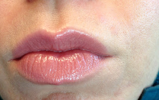 Contouring under lip