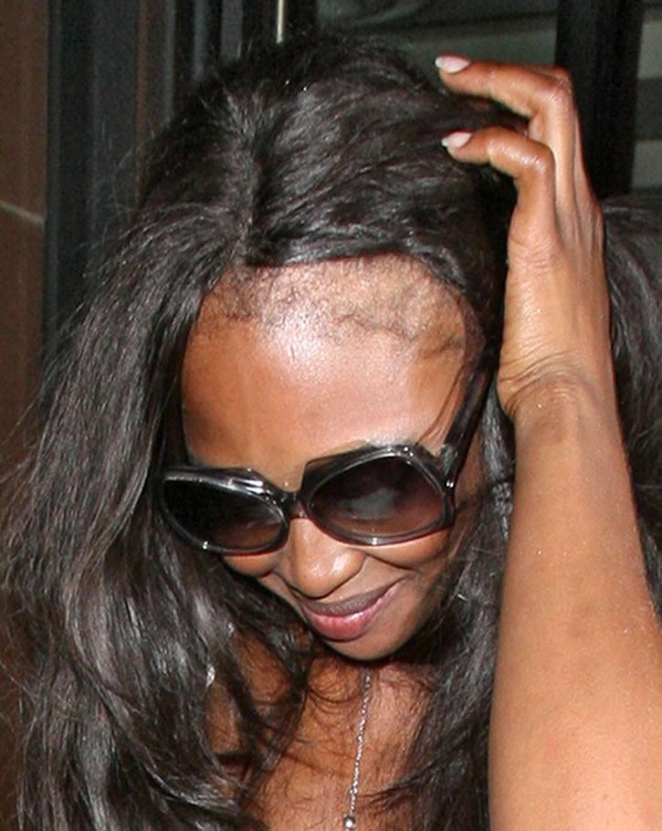 naomi campbell hair loss. Naomi Campbell exposing her