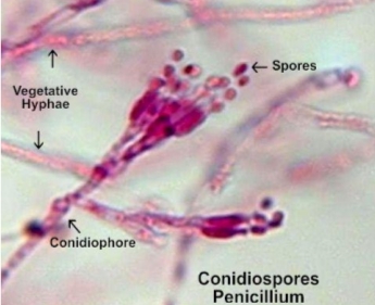 Reproduction in fungi,asexual reproduction,conidiospores