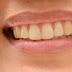 Gigi Putih Dan Mulut Tidak Berbau Dengan Whitekish Magic Charcoal