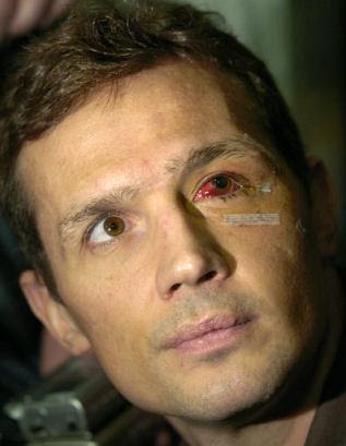 THE PUCK REPORT: Today In NHL History - Puck Hits Yzerman's Eye