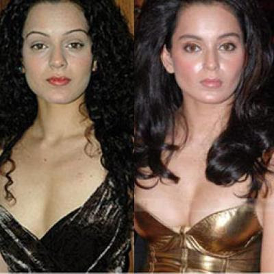 Shocking and Unbelievable Celebrities After Plastic Surgery