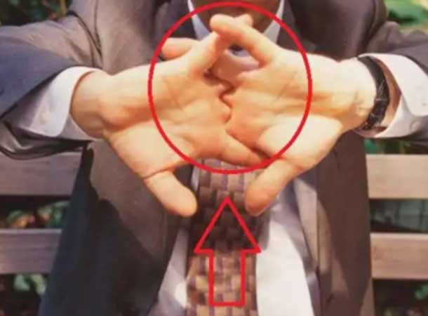 Knuckle Cracking Effects in Hindi: यदि आपको भी बार-बार उंगलियां चटकाने का शौक है तो आप हो सकते हैं इस गंभीर बीमारी का शिकार
