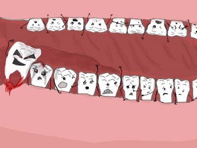 Chăm sóc răng miệng sau khi cắt lợi trùm
