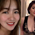 Angeline Quinto gets honest about her cosmetic surgery journey on Instagram