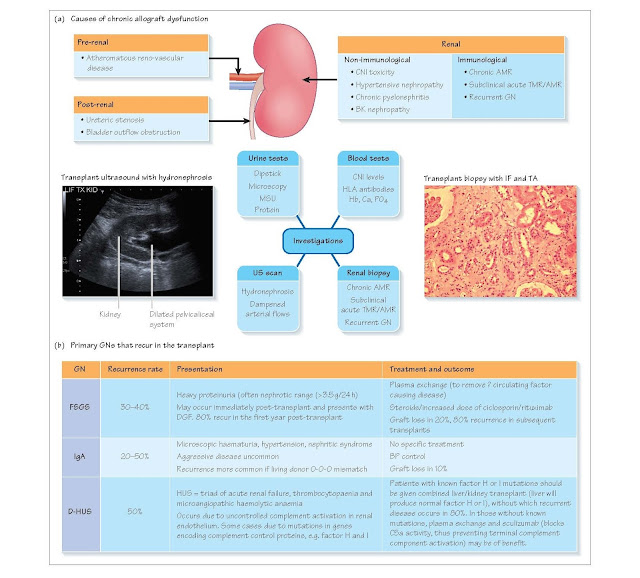 Chronic Renal Allograft Dysfunction