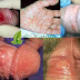 Obat Sipilis Jual Di Kaskus thumbnail