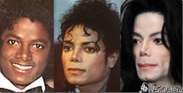 michael jackson, skin color