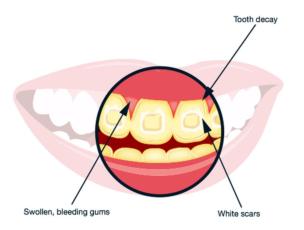 Orthodontics