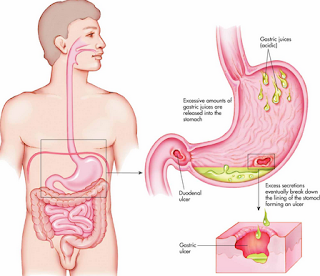 http://obatmaaguntukwanita.blogspot.com/