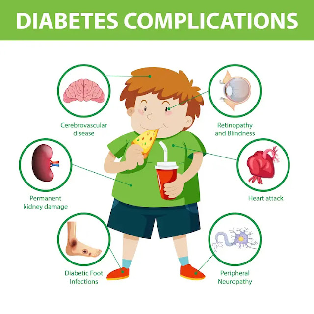 High Cholesterol Can Happen in Children, Here's How to Overcome It