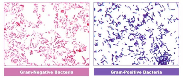 Gram staining of bacteria