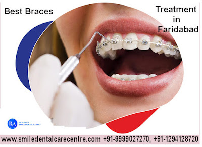 Best Orthodontist in Faridabad