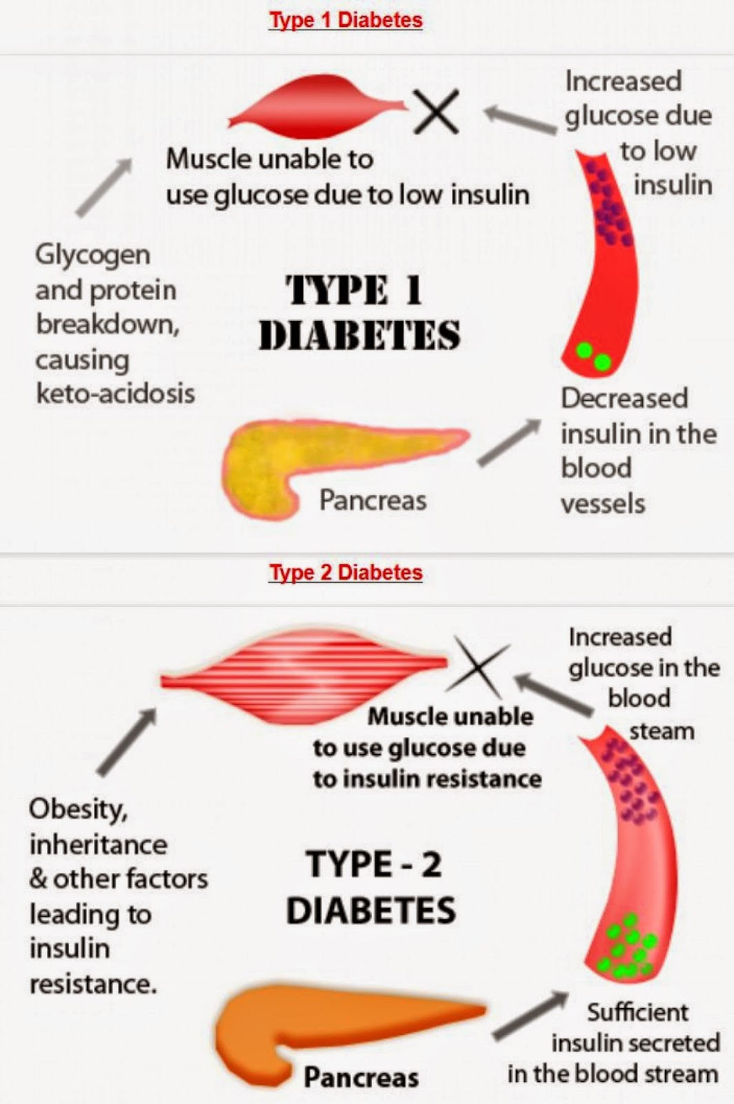 Anda berisiko tinggi menghidap kencing manis / diabetes 