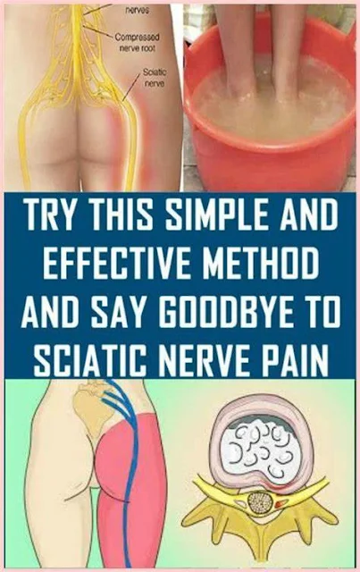 Say Goodbye To Sciatic Nerve Pain In Just 10 Minutes And This Natural Method