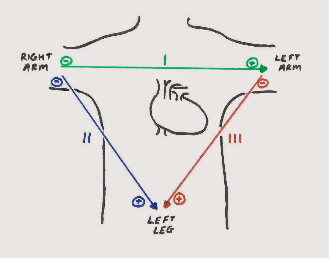 Diagram Of Ecg Leads Images - How To Guide And Refrence