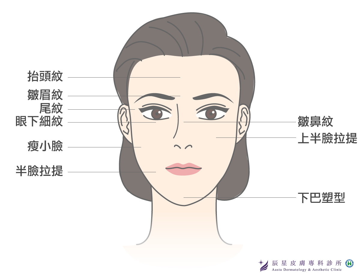 肉毒桿菌效果