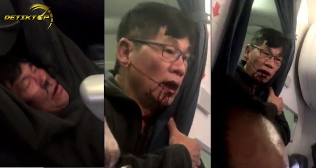 Detiktop - Dokter Dao mengambil jalan hukum atas insiden menimpanya di United Airlines