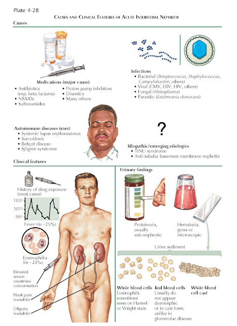 ACUTE INTERSTITIAL NEPHRITIS