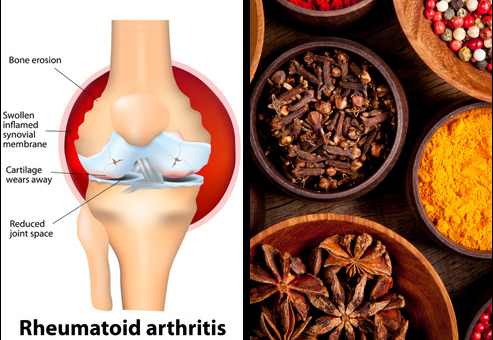 The Natural Cure for Arthritis and Osteoporosis