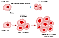 CANCER DE LA PROSTATE