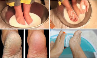 Make Your Feet Look Nice With Just Two Ingredients from Your Kitchen