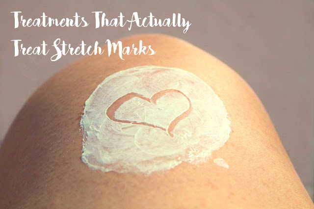 Treatments That Actually Treat Stretch Marks MakeUp Fun. Discover how to treat stretch marks with non-invasive treatments and how to prevent them to appear in the first place!