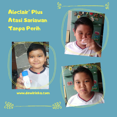 Aloclair® Plus atasi sariawan tanpa perih