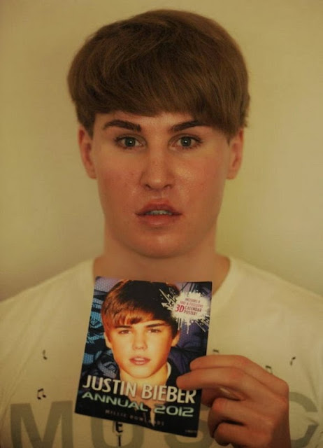 Justin Bieber Plastic Surgery