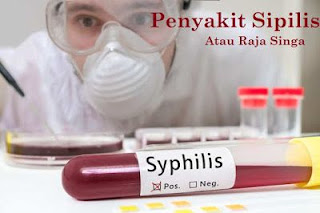 OBAT SIPILIS YANG AMPUH ANJURAN DOKTER DI APOTIK