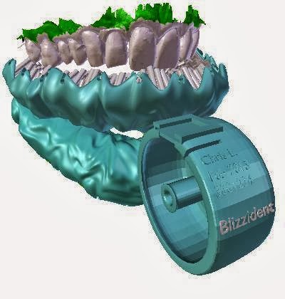 Sikat Gigi 3D Ini Mampu Membersihkan Gigi Anda Dalam 6 Detik